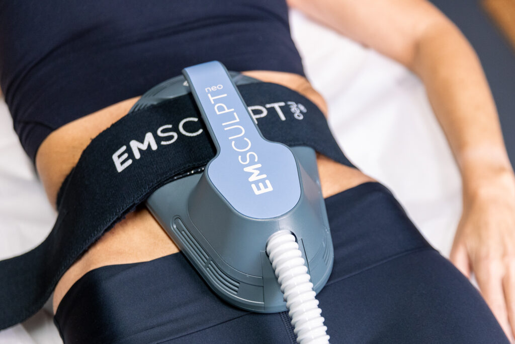 Close up of a woman's abdomen as she receives an inflammation treatment near McLean, VA, with Emsculpt NEO at Sculp'd.