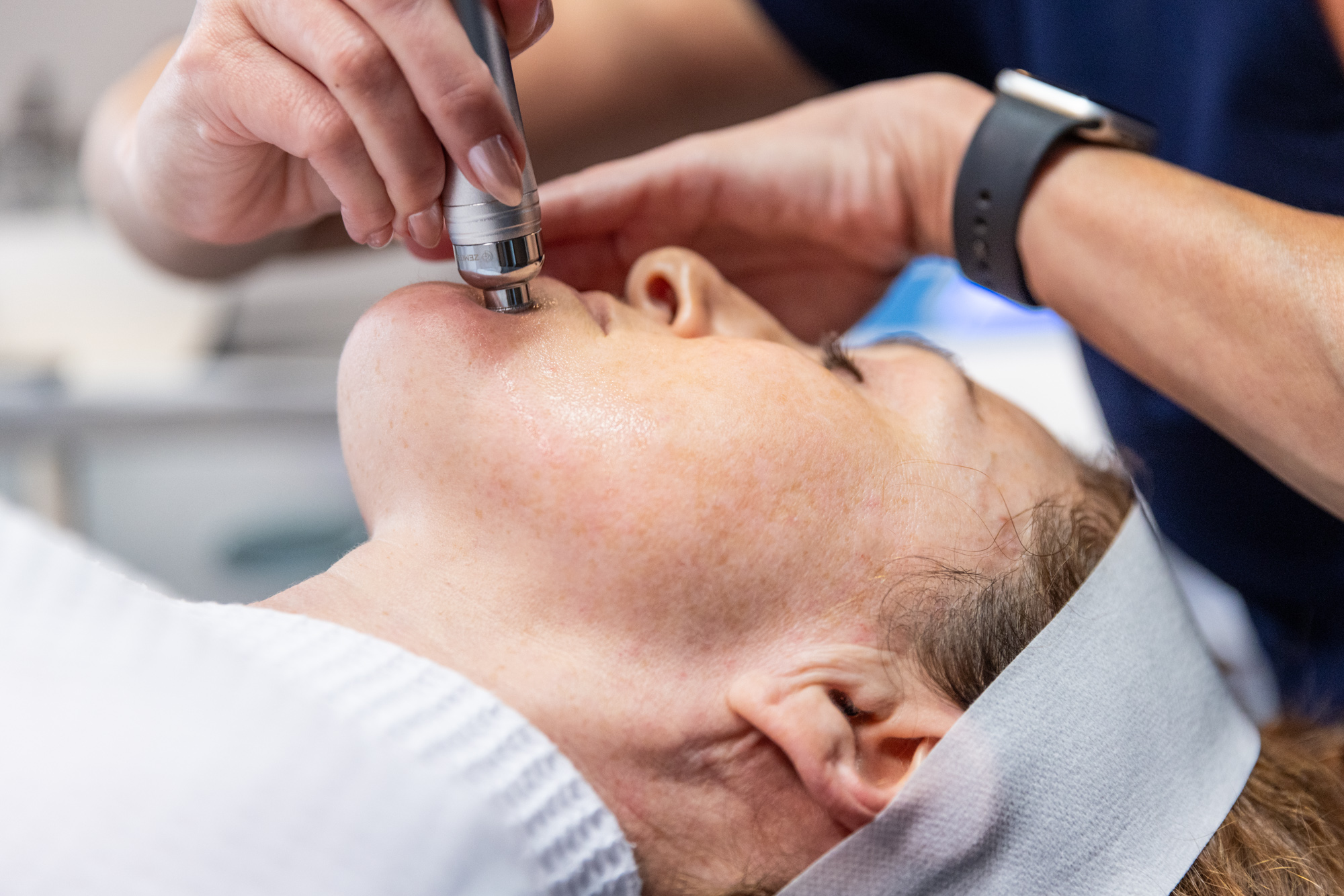 Close up of a woman's neck and face during Skin Toning in Alexandria, VA, using an advanced medical device to administer the treatment.